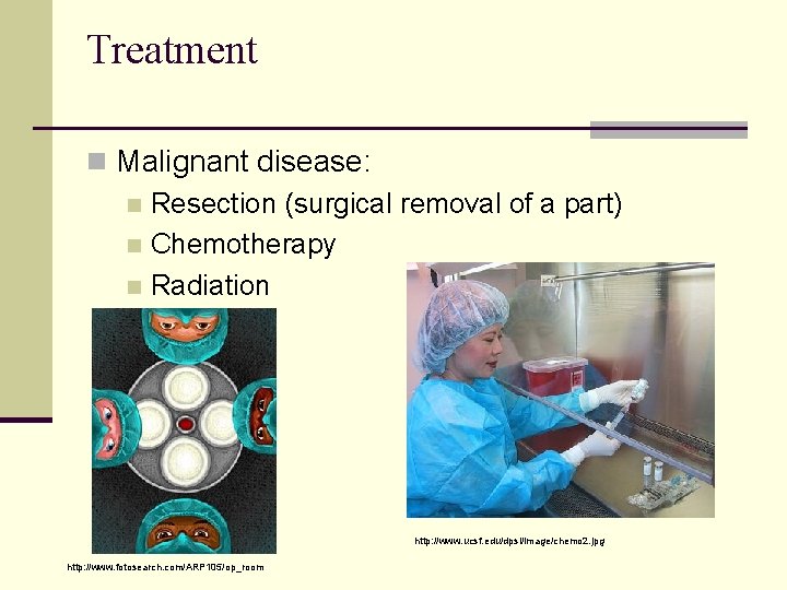 Treatment n Malignant disease: n Resection (surgical removal of a part) n Chemotherapy n