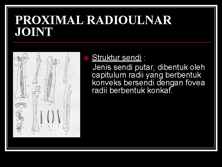 PROXIMAL RADIOULNAR JOINT n Struktur sendi : Jenis sendi putar, dibentuk oleh capitulum radii