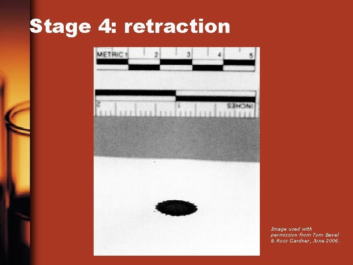 Stage 4: retraction Image used with permission from Tom Bevel & Ross Gardner, June