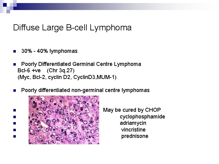 Diffuse Large B-cell Lymphoma n n n n 30% - 40% lymphomas Poorly Differentiated