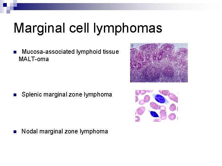 Marginal cell lymphomas n Mucosa-associated lymphoid tissue MALT-oma n Splenic marginal zone lymphoma n