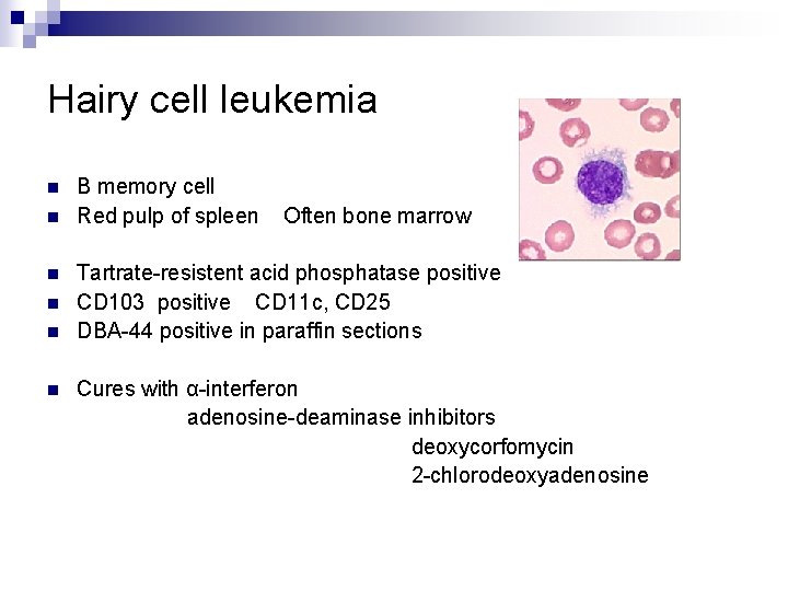 Hairy cell leukemia n n n B memory cell Red pulp of spleen Often