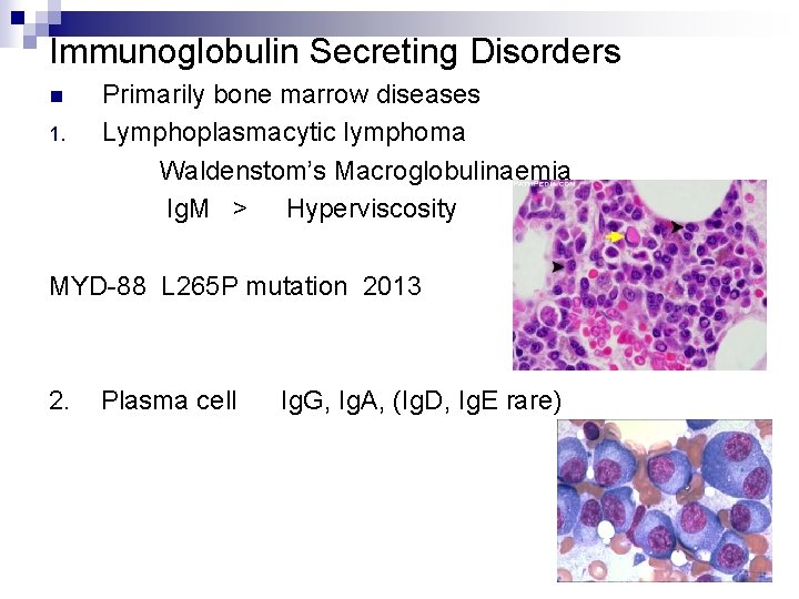 Immunoglobulin Secreting Disorders n 1. Primarily bone marrow diseases Lymphoplasmacytic lymphoma Waldenstom’s Macroglobulinaemia Ig.