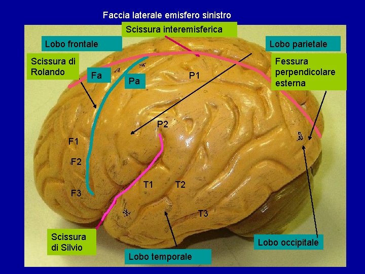 Faccia laterale emisfero sinistro Scissura interemisferica Lobo frontale Scissura di Rolando Fa Lobo parietale