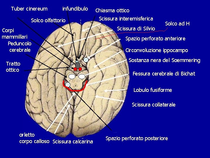 Tuber cinereum infundibulo Solco olfattorio Corpi mammillari Peduncolo cerebrale Tratto ottico Chiasma ottico Scissura