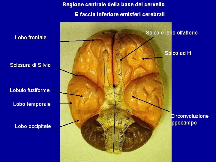 Regione centrale della base del cervello E faccia inferiore emisferi cerebrali Lobo frontale Solco
