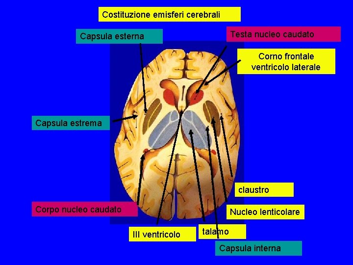 Costituzione emisferi cerebrali Testa nucleo caudato Capsula esterna Corno frontale ventricolo laterale Capsula estrema