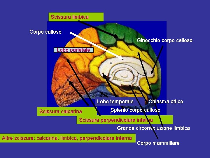 Scissura limbica Corpo calloso Ginocchio corpo calloso Lobo parietale Lobo temporale Scissura calcarina Chiasma