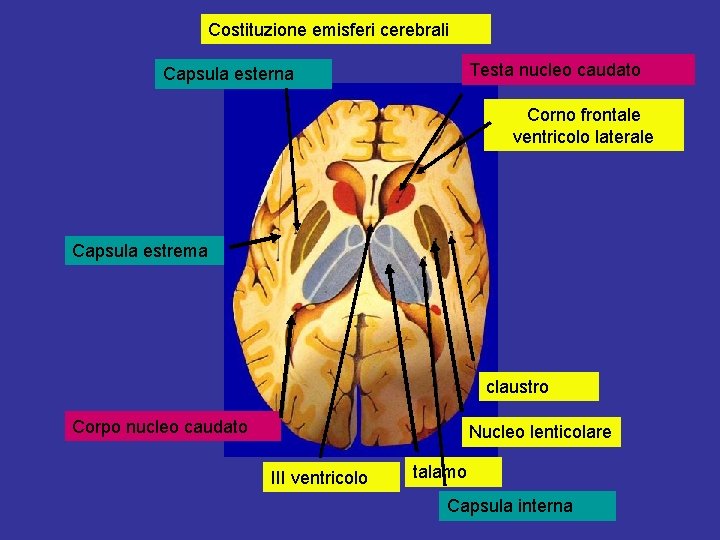 Costituzione emisferi cerebrali Testa nucleo caudato Capsula esterna Corno frontale ventricolo laterale Capsula estrema
