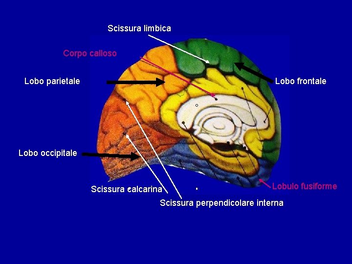 Scissura limbica Corpo calloso Lobo parietale Lobo frontale Lobo occipitale Scissura calcarina Lobulo fusiforme