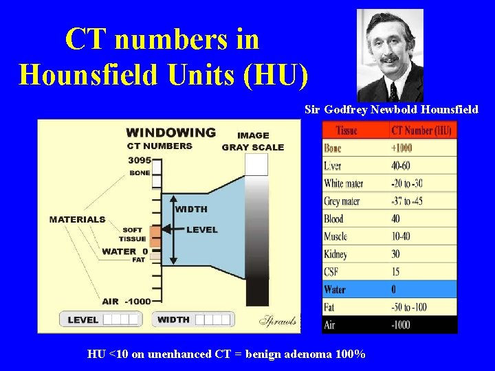 CT numbers in Hounsfield Units (HU) Sir Godfrey Newbold Hounsfield HU <10 on unenhanced