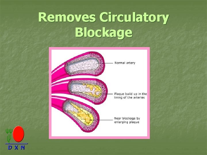 Removes Circulatory Blockage 