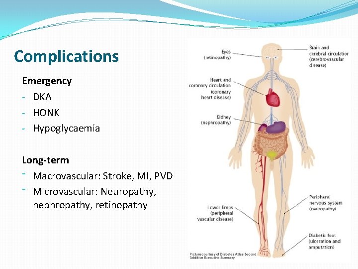 Complications Emergency - DKA - HONK - Hypoglycaemia Long-term ⁻ Macrovascular: Stroke, MI, PVD