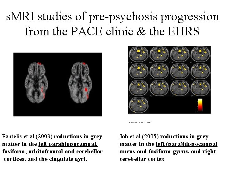 s. MRI studies of pre-psychosis progression from the PACE clinic & the EHRS Pantelis