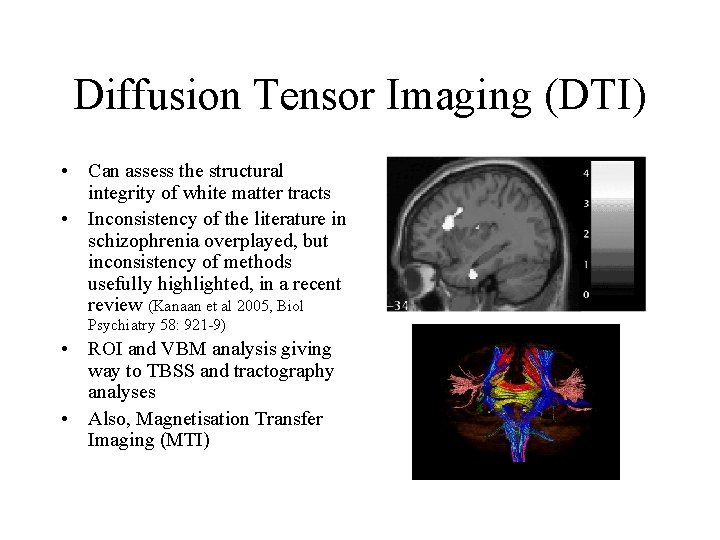 Diffusion Tensor Imaging (DTI) • Can assess the structural integrity of white matter tracts