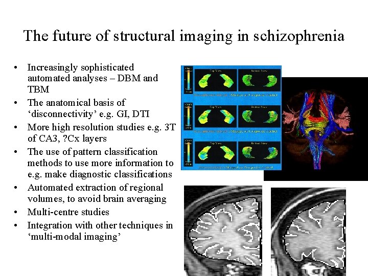 The future of structural imaging in schizophrenia • Increasingly sophisticated automated analyses – DBM