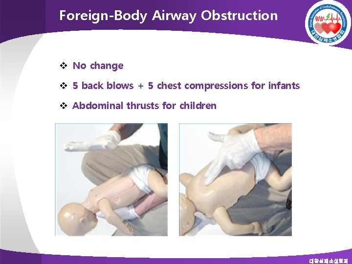 Foreign-Body Airway Obstruction v No change v 5 back blows + 5 chest compressions