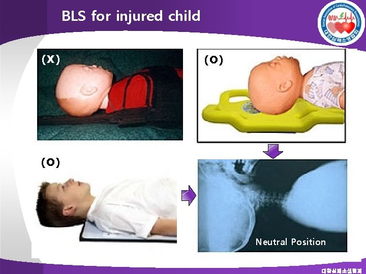 BLS for injured child (X) (O) Neutral Position 대한심폐소생협회 