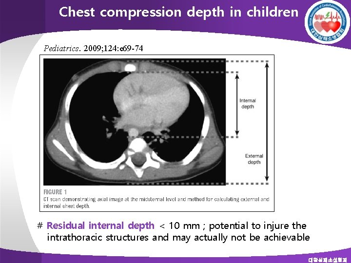 Chest compression depth in children Pediatrics. 2009; 124: e 69 -74 # Residual internal