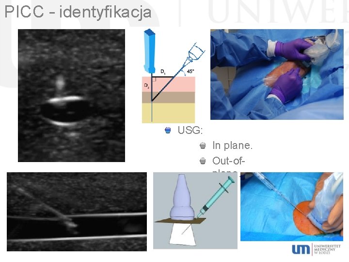 PICC – identyfikacja USG: In plane. Out-ofplane. 