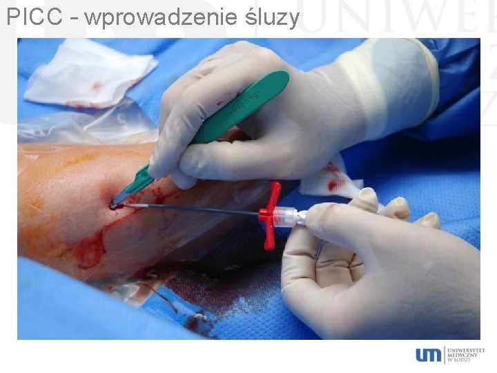 PICC – wprowadzenie śluzy 