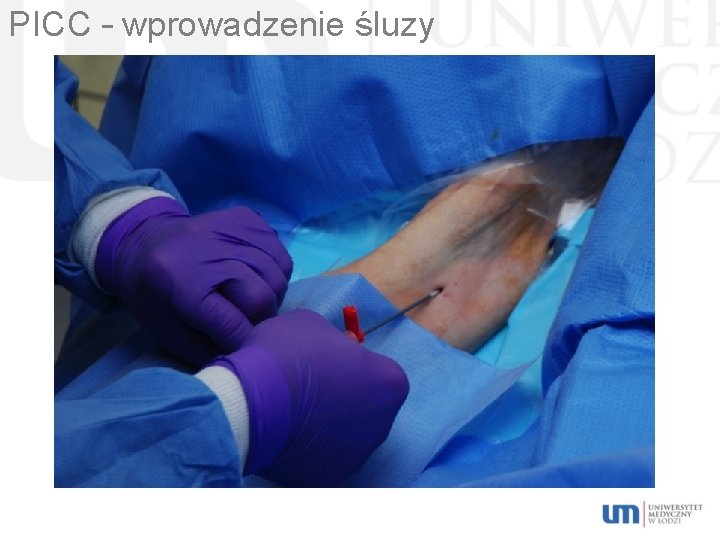 PICC – wprowadzenie śluzy 