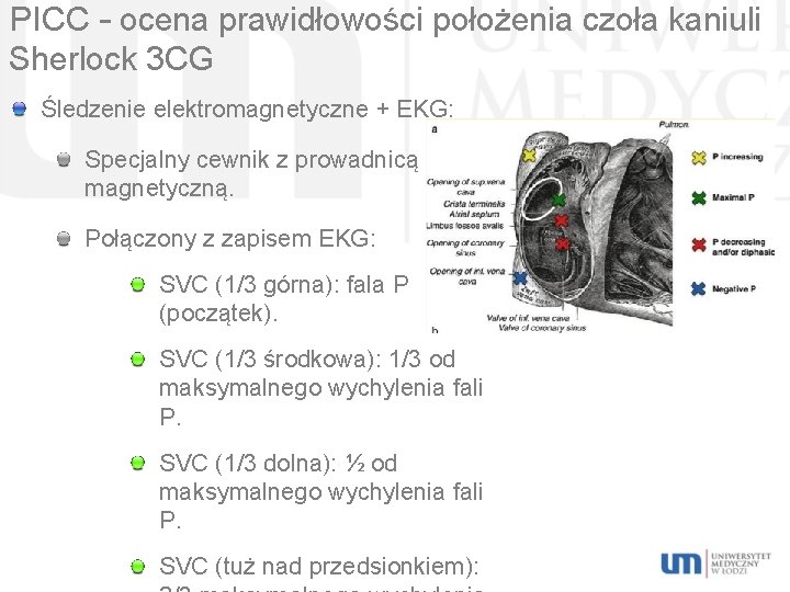 PICC – ocena prawidłowości położenia czoła kaniuli Sherlock 3 CG Śledzenie elektromagnetyczne + EKG: