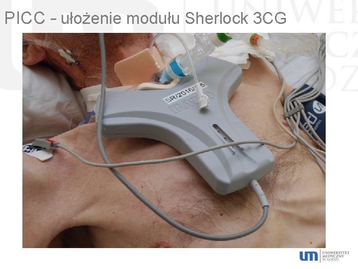 PICC – ułożenie modułu Sherlock 3 CG 