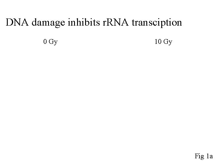 DNA damage inhibits r. RNA transciption 0 Gy 10 Gy Fig 1 a 