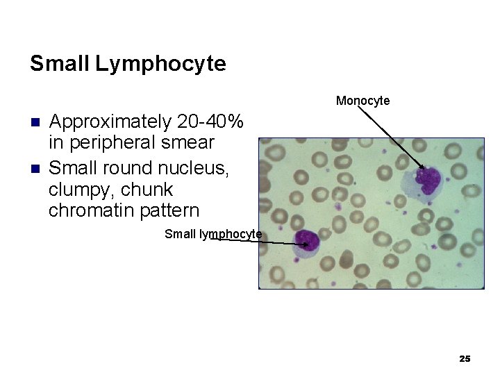 Small Lymphocyte Monocyte n n Approximately 20 -40% in peripheral smear Small round nucleus,