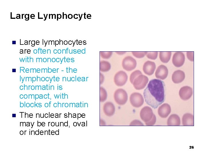 Large Lymphocyte n n n Large lymphocytes are often confused with monocytes Remember -