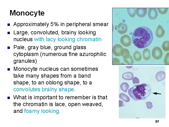 Monocyte n n n Approximately 5% in peripheral smear Large, convoluted, brainy looking nucleus