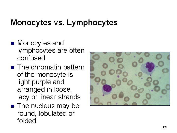 Monocytes vs. Lymphocytes n n n Monocytes and lymphocytes are often confused The chromatin