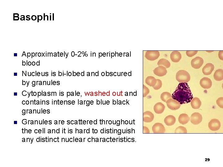 Basophil n n Approximately 0 -2% in peripheral blood Nucleus is bi-lobed and obscured