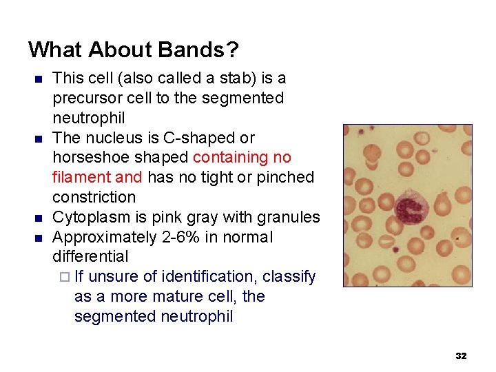 What About Bands? n n This cell (also called a stab) is a precursor