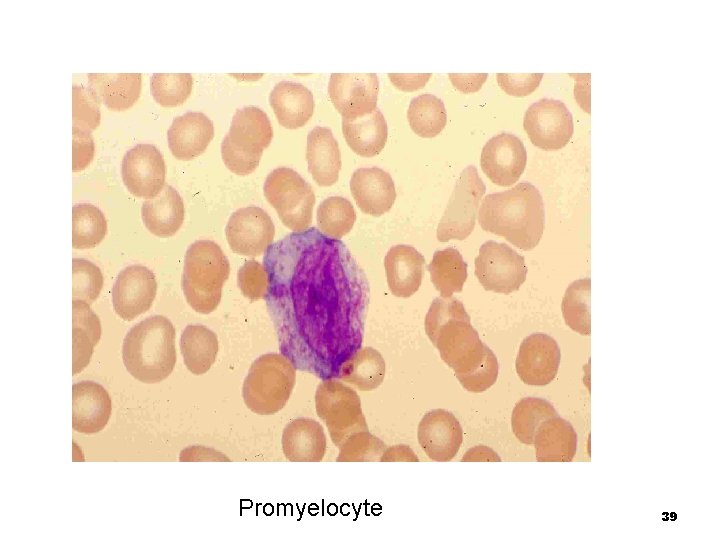 Promyelocyte 39 