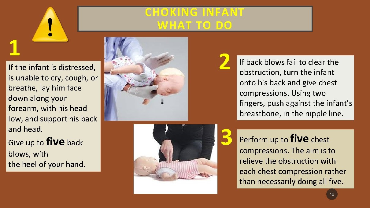 1 If the infant is distressed, is unable to cry, cough, or breathe, lay