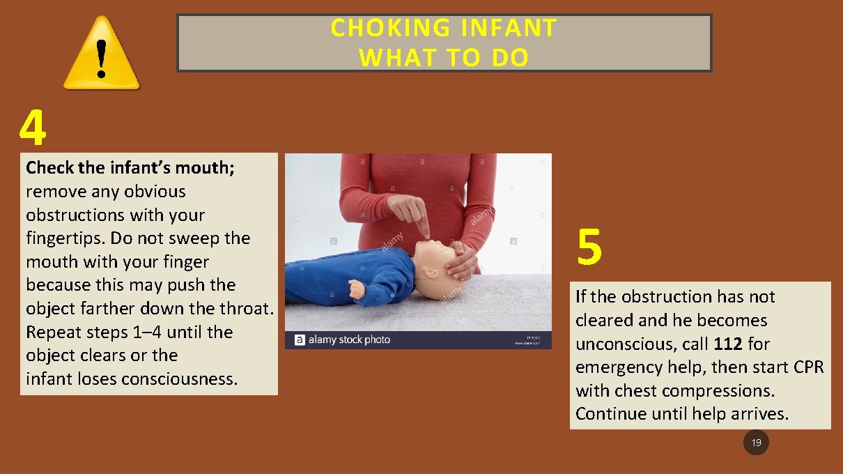 CHOKING INFANT WHAT TO DO 4 Check the infant’s mouth; remove any obvious obstructions