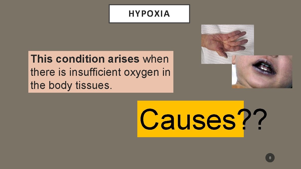 HYPOXIA This condition arises when there is insufficient oxygen in the body tissues. Causes?