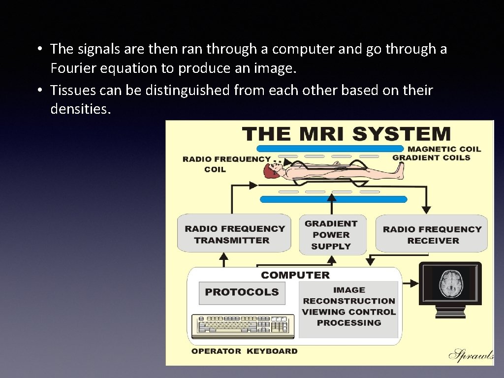  • The signals are then ran through a computer and go through a