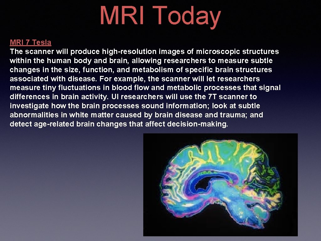 MRI Today MRI 7 Tesla The scanner will produce high-resolution images of microscopic structures