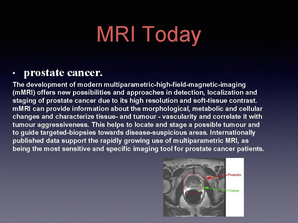 MRI Today • prostate cancer. The development of modern multiparametric-high-field-magnetic-imaging (m. MRI) offers new