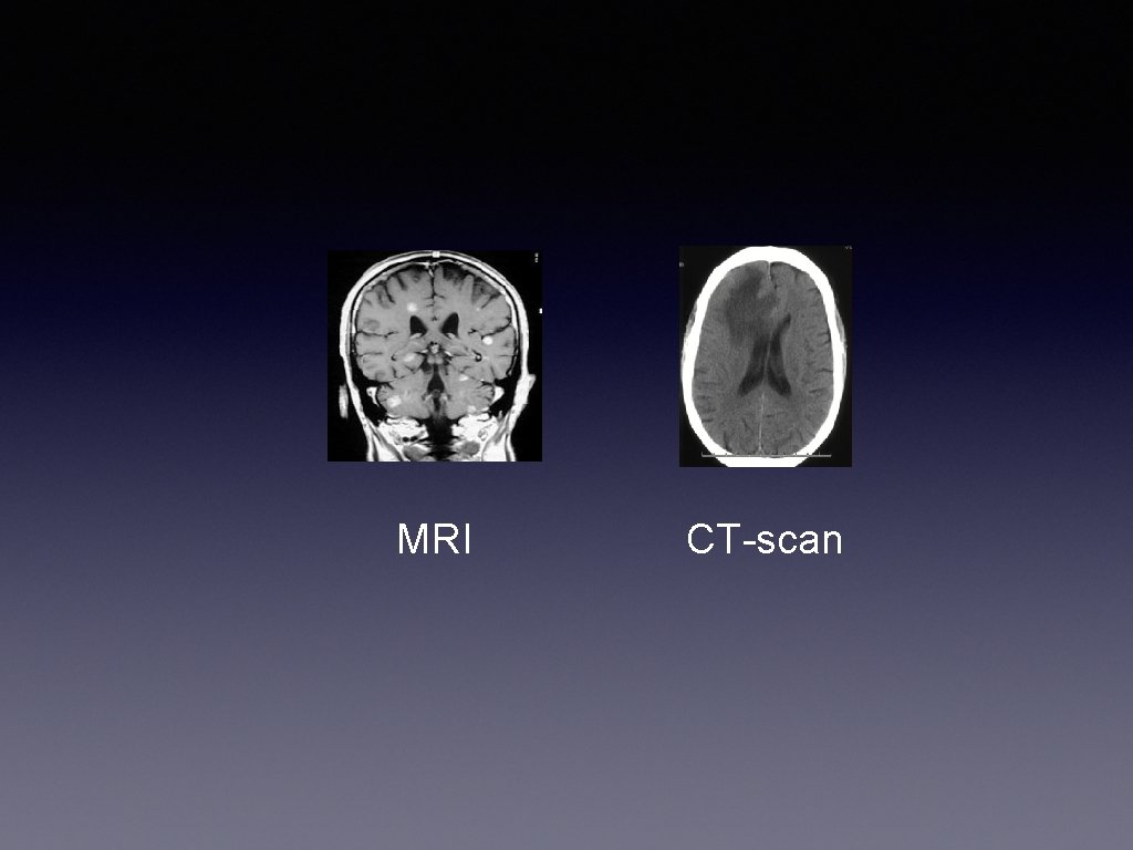 MRI CT-scan 