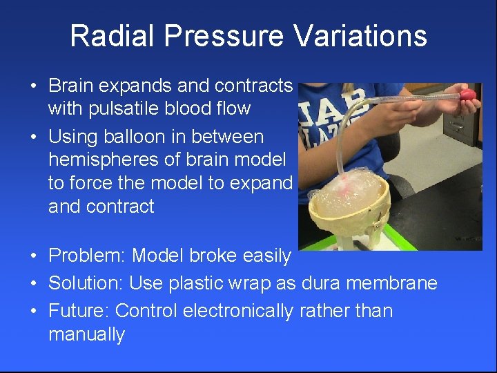 Radial Pressure Variations • Brain expands and contracts with pulsatile blood flow • Using