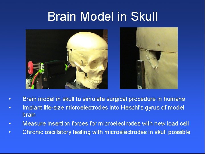 Brain Model in Skull • • Brain model in skull to simulate surgical procedure