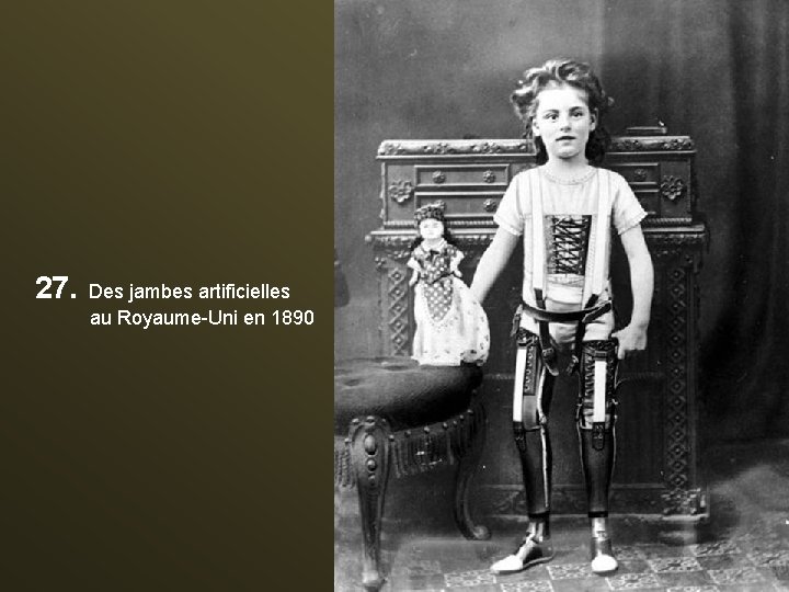 27. Des jambes artificielles au Royaume-Uni en 1890 