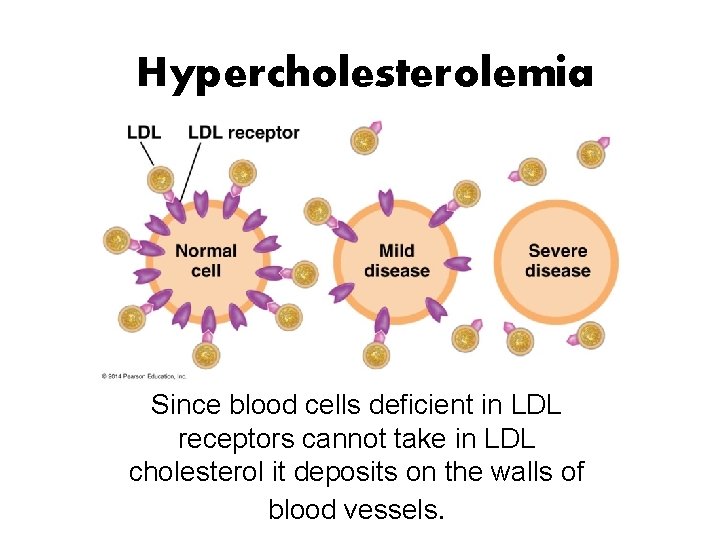 Hypercholesterolemia Since blood cells deficient in LDL receptors cannot take in LDL cholesterol it