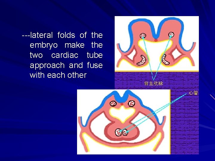 ---lateral folds of the embryo make the two cardiac tube approach and fuse with