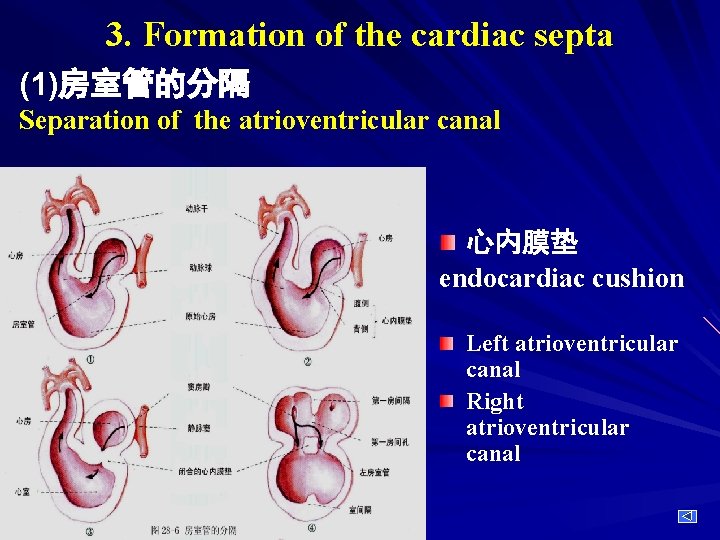 3. Formation of the cardiac septa (1)房室管的分隔 Separation of the atrioventricular canal 心内膜垫 endocardiac