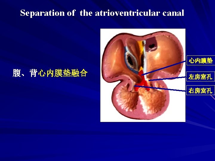 Separation of the atrioventricular canal 心内膜垫 腹、背心内膜垫融合 左房室孔 右房室孔 